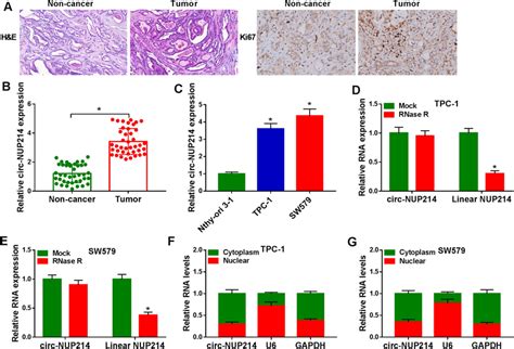 Circ Nup214 Was Increased While Mir 15a 5p Was Decreased In Ptc Tissues