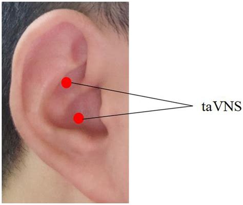 Frontiers Altered Functional Connectivity Of The Thalamus In Patients