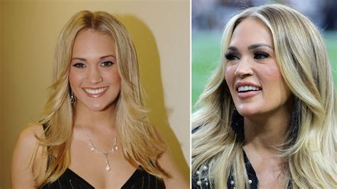 Carrie Underwood Plastic Surgery What Has She Had Done Hello