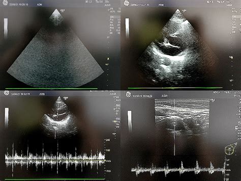 Ultrasound Logiq P7 Ge Used Medical Equipment Supplier In Japan