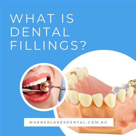 Choosing The Best Type Of Dental Fillings In Warner Dental Fillings Tooth Filling Dental