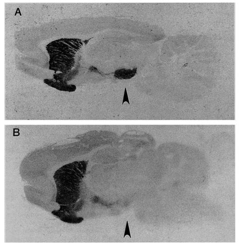 Representative autoradiographs showing D 1 dopamine receptor binding in ...