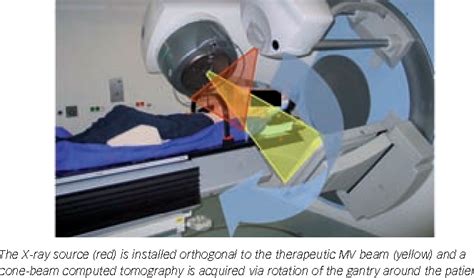 Figure 1 From Image Guided Radiotherapy Based On Kilovoltage Cone Beam