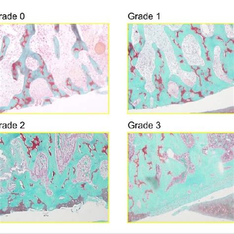 A Histological Evaluation Safranin O Staining B Subchondral Bone