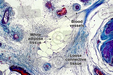 Mammal Unilocular Adipose Tissue Transverse Section 125X