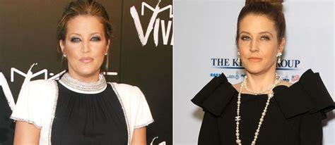 Lisa Marie Presley before and after plastic surgery (36) | Celebrity ...