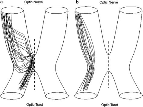 Schematic drawings showing two distinct forms of axon projection to the ... 