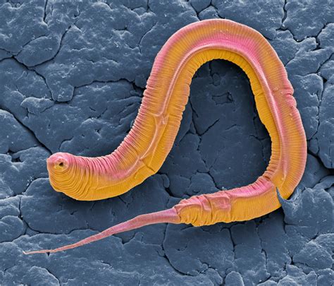 What Do Worms Feel Like In Your Body - Infoupdate.org