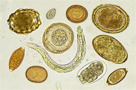 Mixed Of Helminths Or Parasitic Worm In Stool Stock Photo Image Of