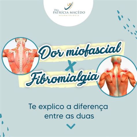 Dor miofascial x Fibromialgia Saiba a diferença entre as duas