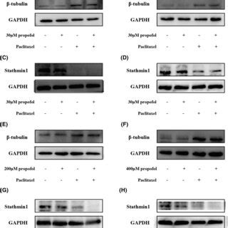 The Effect Of Propofol And Paclitaxel On The Expression Levels Of