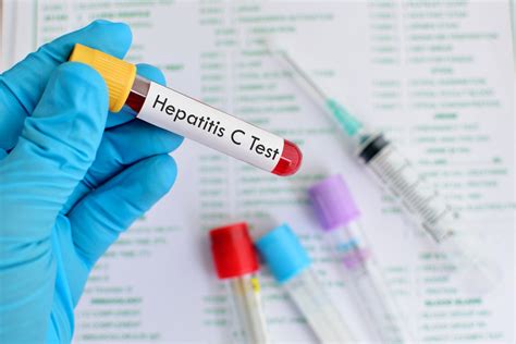 Expensive Hep C Treatment Now Available In Guyana Free Of Cost News Room Guyana