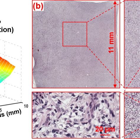 Pincushion distortion correction. (a) Image stitching errors due to... | Download Scientific Diagram