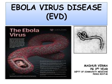 Ebola virus disease