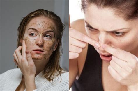 Tak Perlu Repot Facial Komedo Membandel Di Hidung Bisa Langsung Hempas