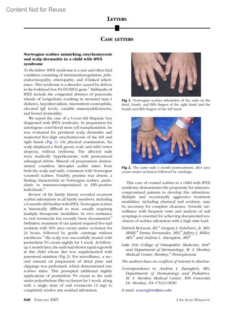 Norwegian scabies mimicking onychomycosis and... : Journal of the