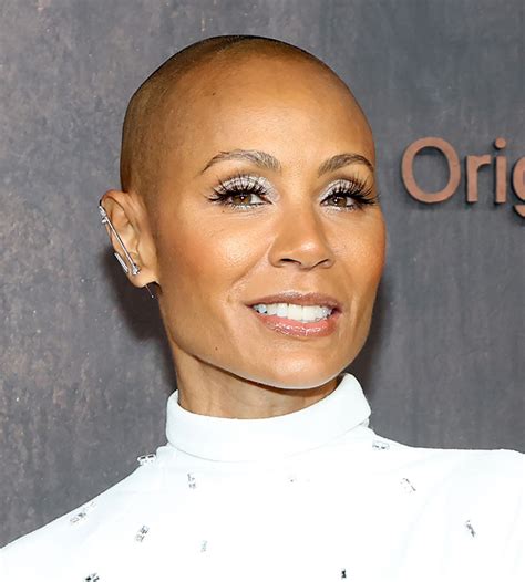 10 Celebrity Females Who Lost Their Hair Shefinds