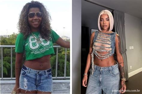 Ludmilla Antes E Depois Da Cantora Ap S Cirurgias