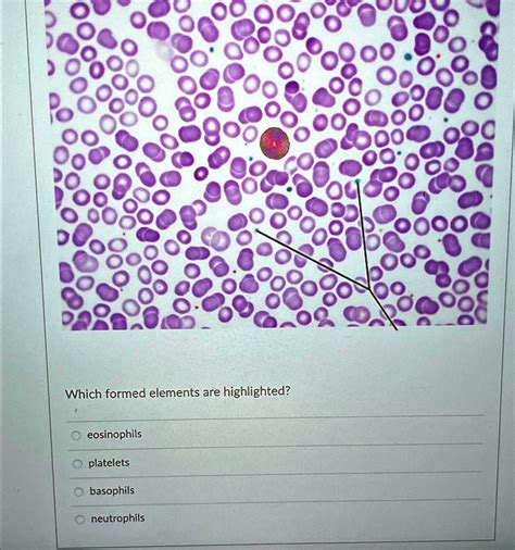 Solved Which Formed Elements Are Highlighted Eosinophils Platelets