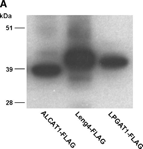 The Microsomal Cardiolipin Remodeling Enzyme Acyl Coa Lysocardiolipin