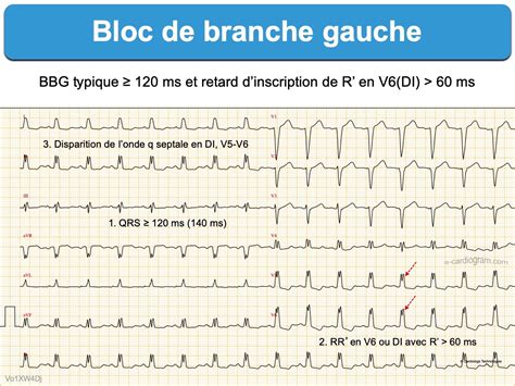 Lexique B E Cardiogram