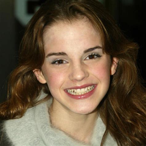 Emma Watson Beauty Evolution Amica Foto 8