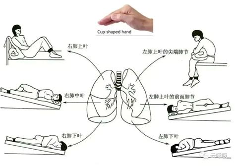 世界支扩日｜用对方法，减少支气管扩张急性加重生命科学澎湃新闻 The Paper