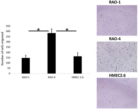 Characterization Of Immortalized Human Mammary Epithelial Cell Line