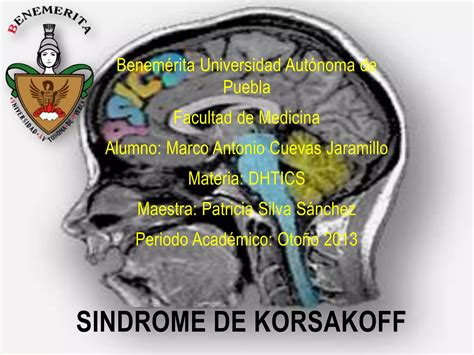 Sindrome De Korsakoff Buap Ppt