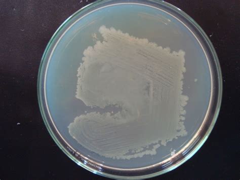 Colony morphology of Bacillus sp. CS14 | Download Scientific Diagram