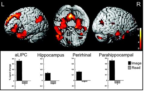 Multiple Routes To Memory Distinct Medial Temporal Lobe Processes