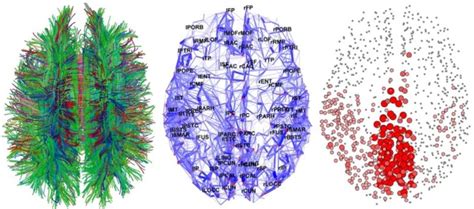 Brain Connections Resting State Fmri Functional Connectivity Intechopen