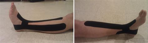 Figure 3 From The Effects Of Kinesio Taping® On Postural Control