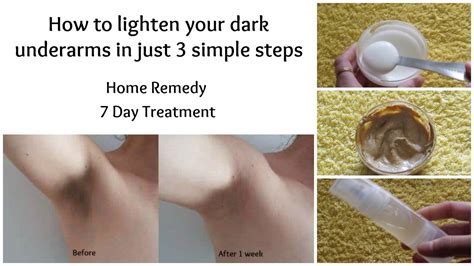 How To Whiten Dark Underarms In Just Days Home Remedy Youtube