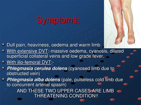 Ppt Deep Venous Thrombosis Powerpoint Presentation Free Download