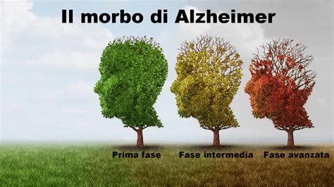 Il Morbo Di Alzheimer E Le Strutture Di Assistenza Slide Di Igiene