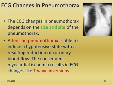 Role Of Ecg In Pulmonology