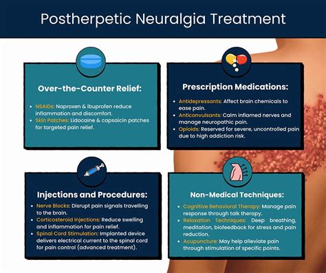 Postherpetic Neuralgia Treatment NYC Pain Management NYC