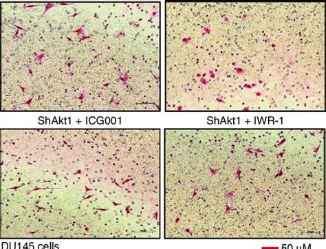 Pharmacological inhibition of Akt reduces the expression of ... 
