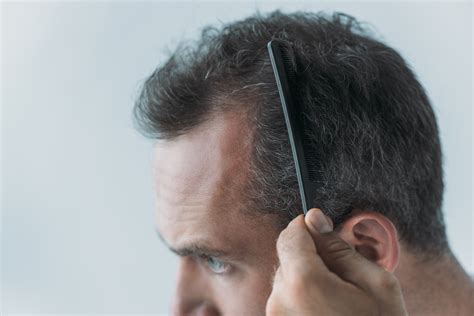 How To Help Prevent Grey Hair In Men Cutters Yard