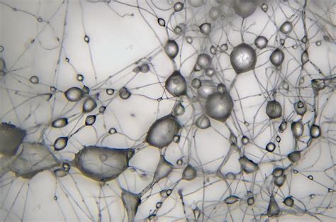 Lion's mane mycelium under the microscope - are these water droplets ...