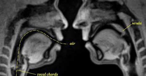 Watch Well Here S What It Looks Like To Have Sex In An MRI Machine Warning It S Gross
