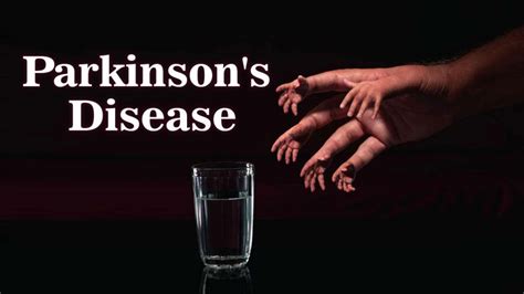 परकसनस रग क लकषण करण और बचव Parkinson s disease in Hindi