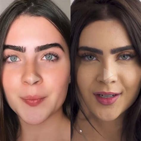 Jade Picon Antes E Depois Fotos Da Sister Do Bbb Ap S Procedimentos