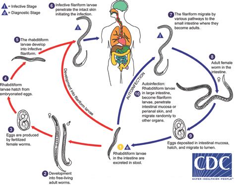 Strongyloides Stercoralis Cdc