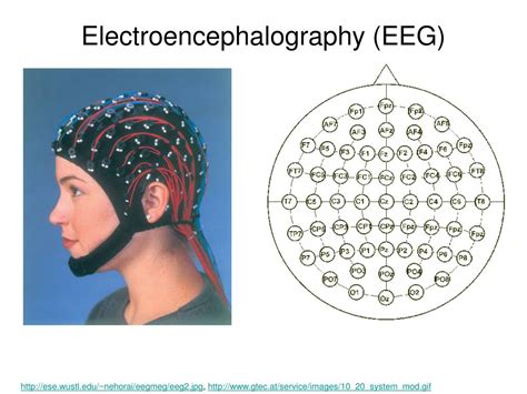 PPT - Electroencephalography (EEG) PowerPoint Presentation, free ...