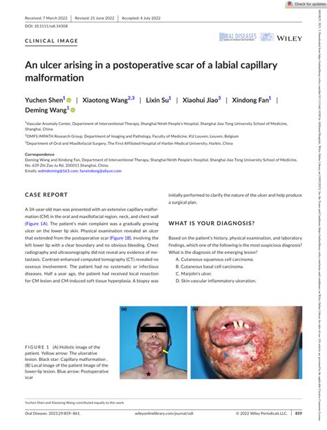 Pdf An Ulcer Arising In A Postoperative Scar Of A Labial Capillary