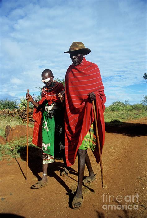 Eye Surgery Patient By Jason Kelvin Science Photo Library