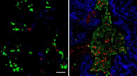 Life-Threatening Lung Disease Averted in Experimental Models | UC San ...