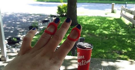 3d Printed Finger Braces For Eds Arthritis Imgur